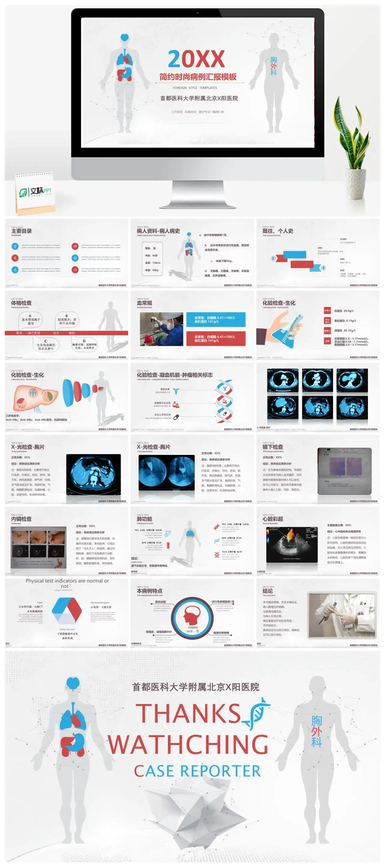 首都医科大学附属北京X医院病例汇报PPT模板