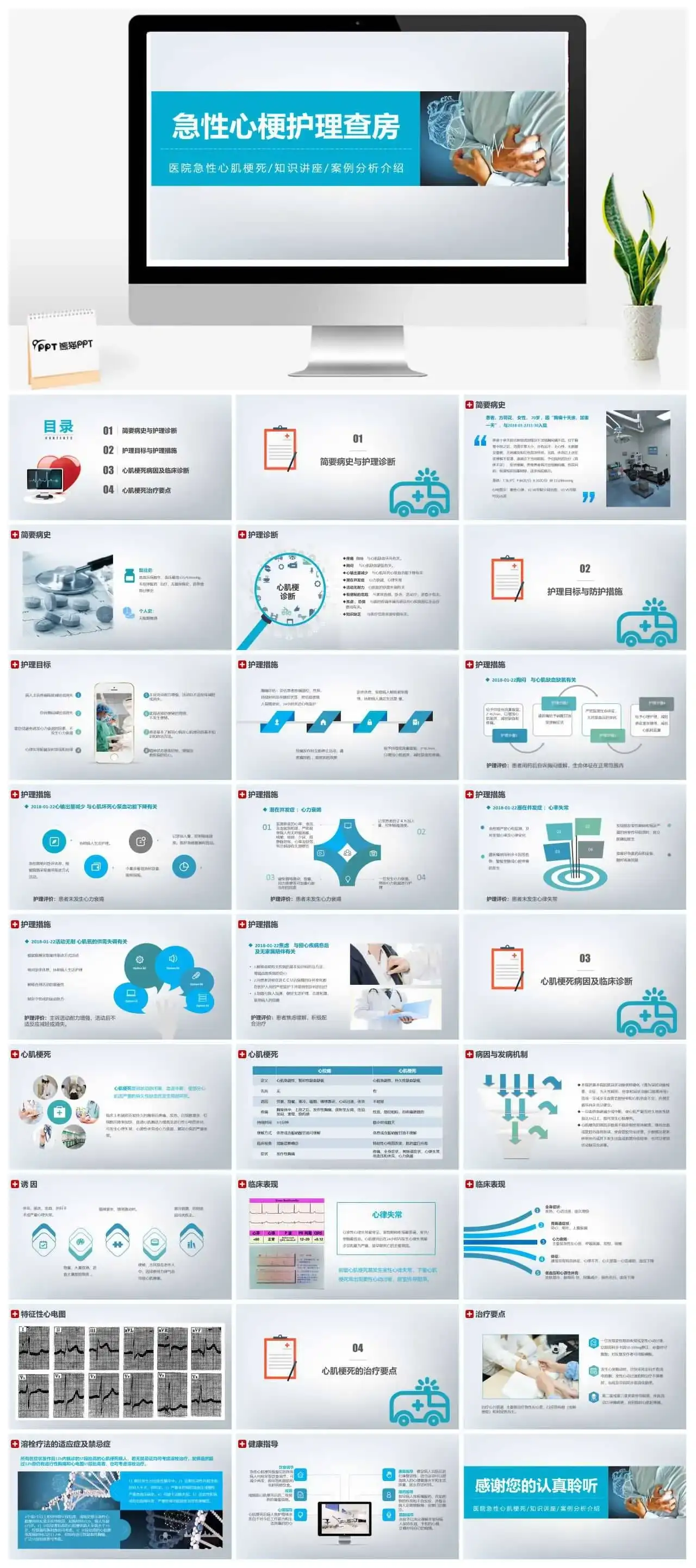 医疗急性心肌梗塞护理查房培训PPT模板
