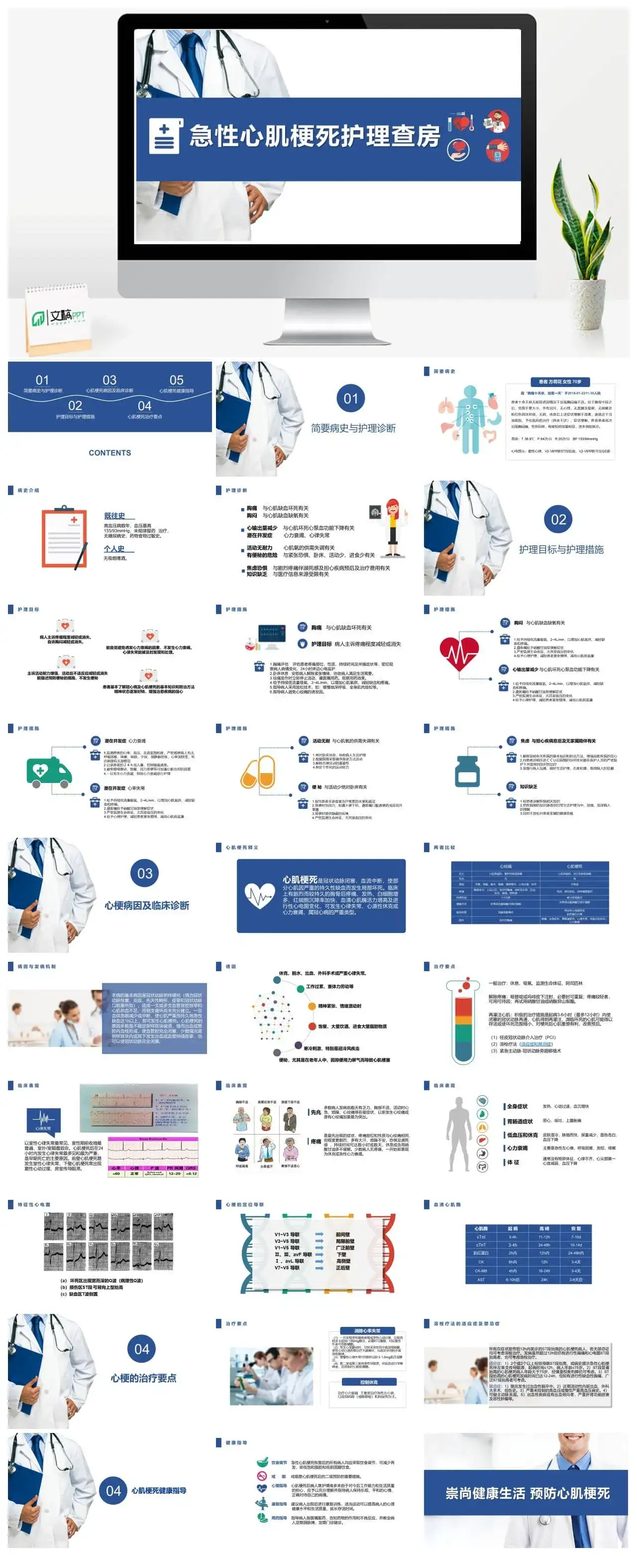 扁平化风格蓝色医疗急性心梗护理查房PPT模板