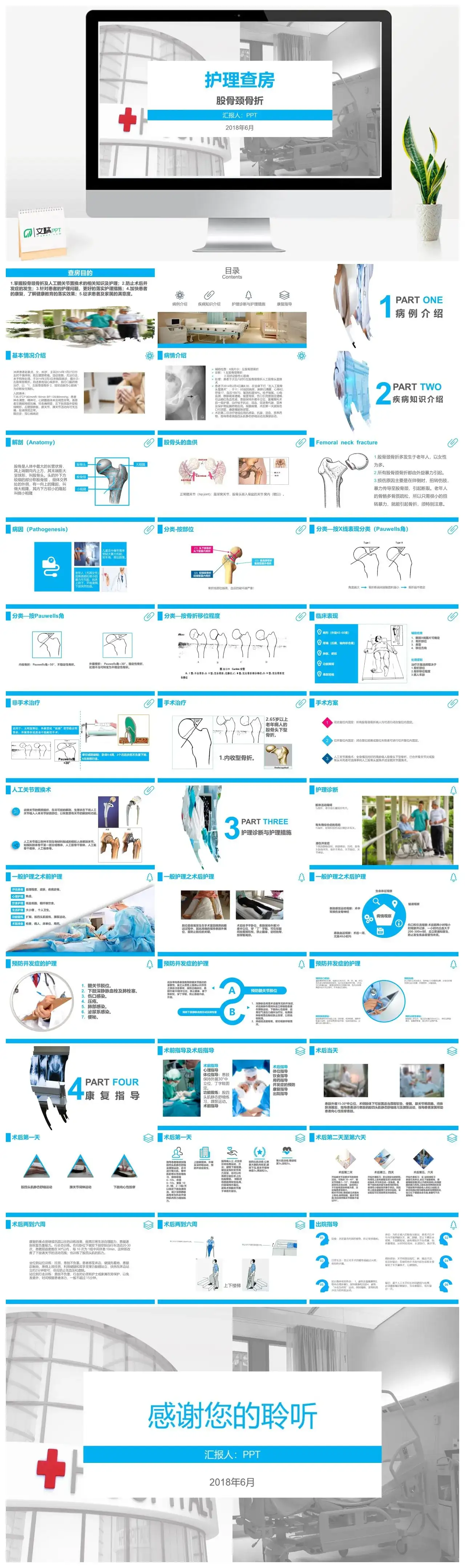 股骨颈骨折的护理查房幻灯片素材