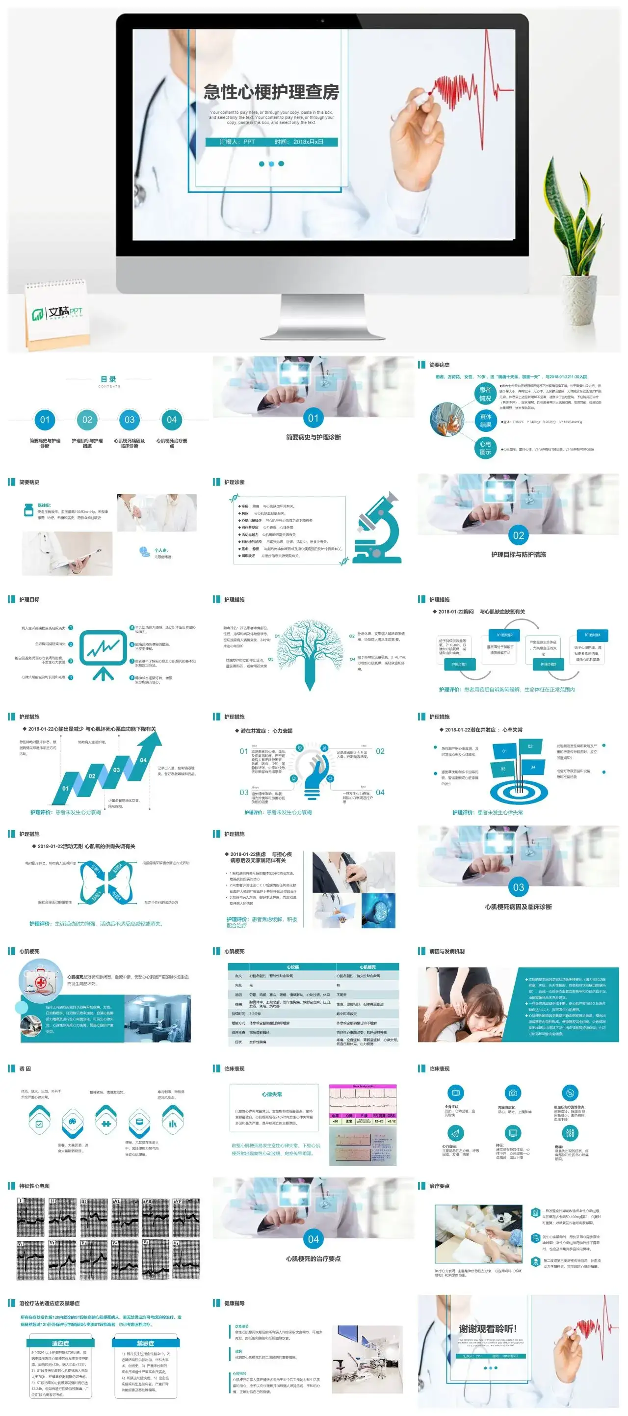 急性心梗病例汇报幻灯片素材